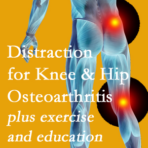 A chiropractic treatment plan for Minster knee pain and hip pain due to osteoarthritis: education, exercise, distraction.