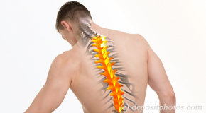Minster thoracic spine pain image 