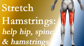 Minster Chiropractic Center promotes back pain patients to stretch hamstrings for length, range of motion and flexibility to support the spine.