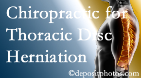 Minster Chiropractic Center diagnoses and manages thoracic disc herniation pain and relieves its symptoms like unexplained abdominal pain or other gastrointestinal issues. 