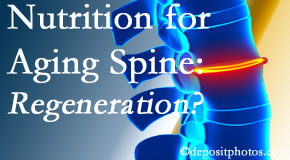 Minster Chiropractic Center sets individual treatment plans for patients with disc degeneration, a consequence of normal aging process, that eases back pain and holds hope for regeneration. 