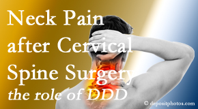 Minster Chiropractic Center offers gentle care for neck pain after neck surgery.