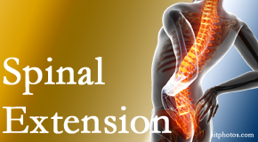 Minster Chiropractic Center knows the role of extension in spinal motion, its necessity, its benefits and potential harmful effects. 
