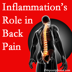 The role of inflammation in Minster back pain is real. Chiropractic care can help.