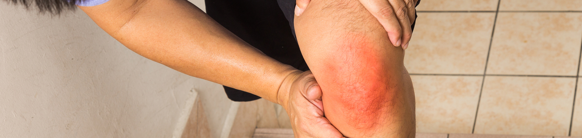 Minster knee pain, osteoarthritis