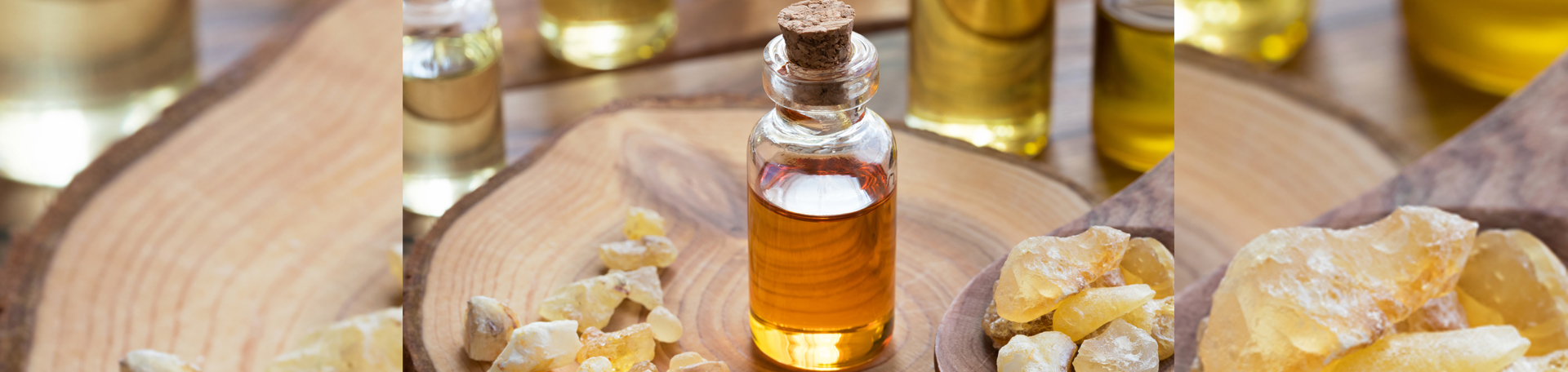 Minster anti-inflammatory frankincense