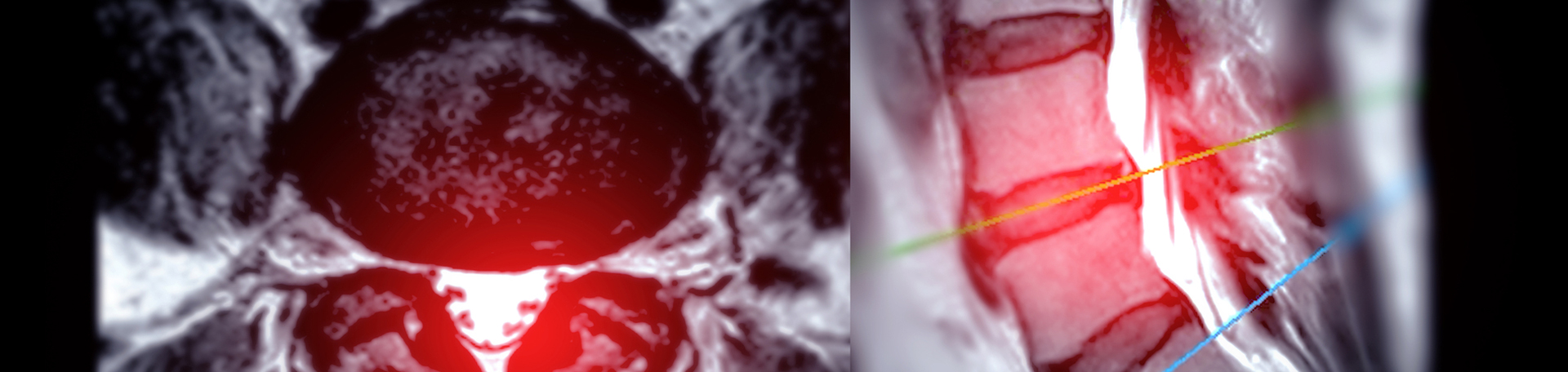 Minster back pain imaging and exercise