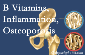 Minster chiropractic care of osteoporosis usually comes with nutritional tips like b vitamins for inflammation reduction and for prevention.