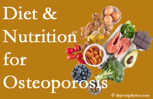 Minster osteoporosis prevention tips from your chiropractor include improved diet and nutrition and decreased sodium, bad fats, and sugar intake. 