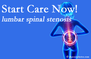 Minster Chiropractic Center presents research that emphasizes that non-operative treatment for spinal stenosis within a month of diagnosis is beneficial. 
