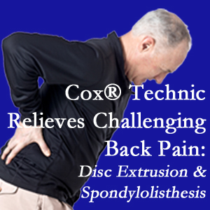 Minster chiropractic care with Cox Technic alleviates back pain due to a painful combination of a disc extrusion and a spondylolytic spondylolisthesis.