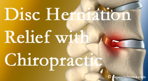 Minster Chiropractic Center gently treats the disc herniation causing back pain. 